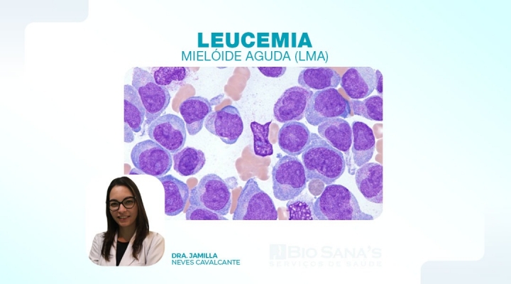Leucemia Mielóide Aguda (LMA)