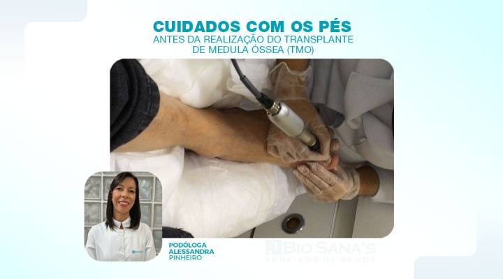 Cuidados com os pés antes da realização do Transplante de Medula Óssea(TMO)