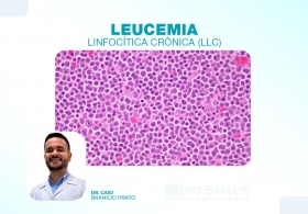Leucemia Linfocítica Crônica