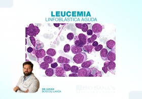 Leucemia Linfoblástica Aguda