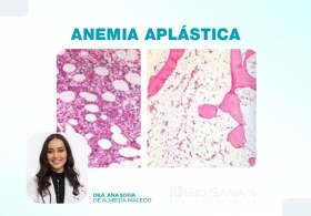 Anemia aplástica (AA) 